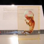 Fötus als Platinat - körperwelten Ausstellung