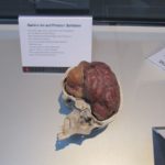 gehirn im geöffneten schädel körperwelten ausstellung